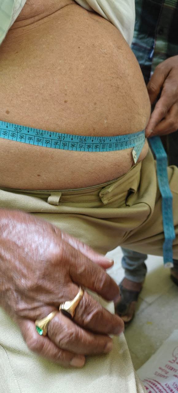 Obesity and belly fat reversal success - 90-day metabolic program in Gachibowli Hyderabad with Dr. Muddu Surendra Nehru MD